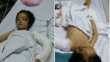 Bà và mẹ mất trên đường đi khám bệnh: Bé gái 6 tuổi đau đớn trên giường bệnh