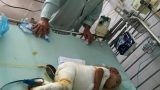 Đau xót: Bé gái 21 tháng tuổi ở Nam Định ngã vào nồi canh 25 lít, bỏng nặng toàn thân