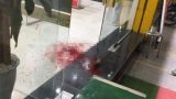 Nam Định: Nam thanh niên bị chém gục tại cửa hàng ViettelStore