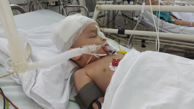 Nam Định: Em bé bị tivi rơi vào đầu đã qua đời