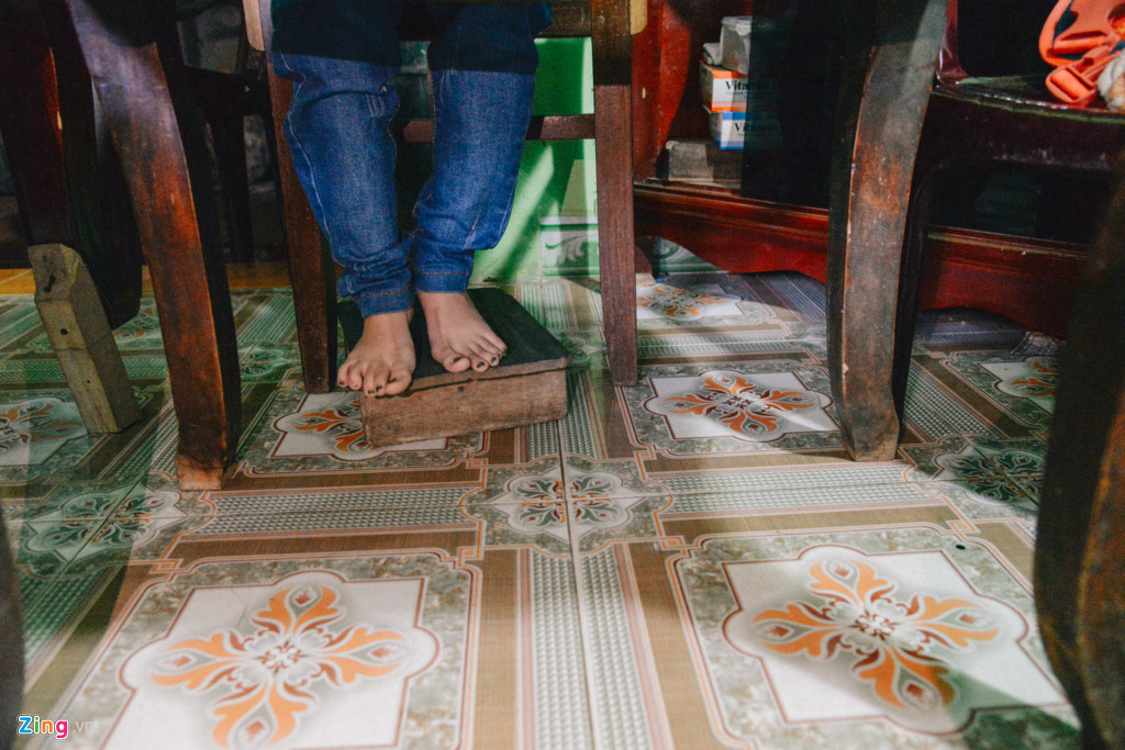 Sinh ra không được may mắn như các bạn đồng trang lứa, Nguyễn Thị Ngọc Tâm, 27 tuổi, bị mắc bệnh xương thủy tinh, một chân bị ngoặt lên trên. Nhờ can thiệp của khoa học, Tâm đã duỗi thẳng được chân nhưng sức khỏe giảm sút.