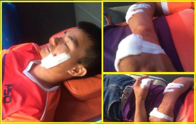 Nam Định: Tài xế xe buýt bị chém nhập viện nghi mâu thuẫn giành khách