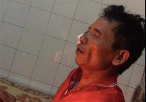 Cận mặt đối tượng gây án trên bàn nhậu ở Nam Định khiến 1 người chết