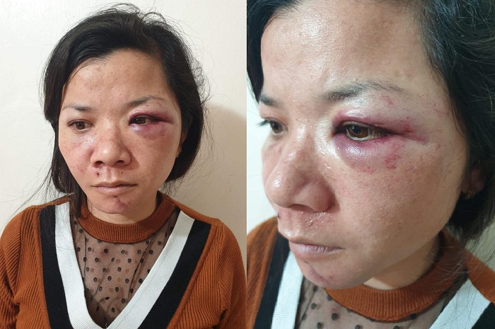 Người chồng đánh đập vợ dã man ở Nam Định bị phạt gần 5 triệu đồng
