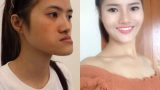 9X Nam Định thoát kiếp “mặt lưỡi cày” sau 23 năm