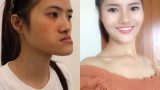 9X Nam Định thoát kiếp “mặt lưỡi cày” sau 23 năm