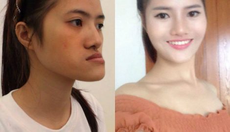9X Nam Định thoát kiếp “mặt lưỡi cày” sau 23 năm