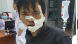 Chém nhau kinh hoàng trên phố, 5 người nhập viện