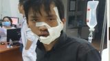 Chém nhau kinh hoàng trên phố, 5 người nhập viện