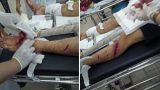Nam Định: Hơn 10 côn đồ mang dao, kiếm chém người trọng thương Nam Định: Hơn 10 côn đồ mang dao, kiếm chém người trọng thương