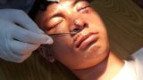 Trên đường đi học, nam sinh bị chó dữ tấn công phải khâu hơn 20 mũi ở mặt