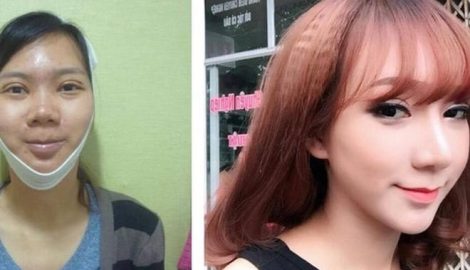 Lời chia sẻ của cô gái có ngoại hình “gây ồn ào” nhất những ngày qua trên mạng xã hội