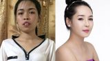 Hot girl Nam Định ước tính “đập toàn mặt” tốn 1,5 tỷ đồng