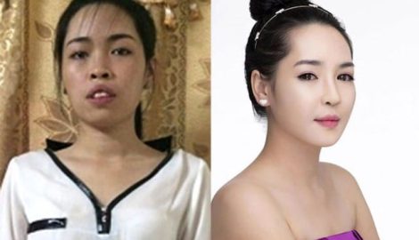 Hot girl Nam Định ước tính “đập toàn mặt” tốn 1,5 tỷ đồng