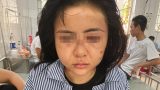 Khởi tố kẻ hành hung cô gái suốt 2 giờ