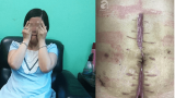 Ba lần nhập viện bác sĩ mới tìm ra bệnh, sản phụ đau đớn mất con đầu lòng