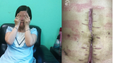 Ba lần nhập viện bác sĩ mới tìm ra bệnh, sản phụ đau đớn mất con đầu lòng