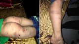Bố đánh con trai 9 tuổi chi chít sẹo: “Tôi không lấy vợ 2 vì còn con cái” Bố đánh con trai 9 tuổi chi chít sẹo: “Tôi không lấy vợ 2 vì còn con cái”