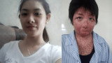 Cuộc sống tươi mới của người phụ nữ xinh đẹp bị chồng tẩm xăng đốt
