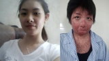 Cuộc sống tươi mới của người phụ nữ xinh đẹp bị chồng tẩm xăng đốt