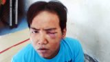 Bảo vệ dân phố giết bé trai 6 tuổi: Dân ngỡ ngàng khi nghi phạm từng bị tâm thần
