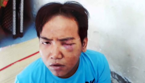 Bảo vệ dân phố giết bé trai 6 tuổi: Dân ngỡ ngàng khi nghi phạm từng bị tâm thần