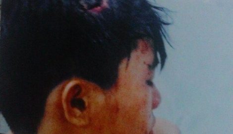 Nam Định: Vô tình ném vỏ khế… ‘ăn’ ngay cuốc xẻng