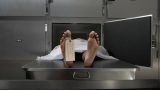Chuẩn bị mổ tử thi, bỗng thấy “xác chết” ngáy rồi tỉnh dậy hỏi về vợ