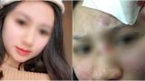 Người vợ xinh đẹp “tố” bị chồng đánh rách đầu, mang bầu cũng hành hung không tha