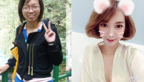 Hậu sửa mặt, nâng ngực tiền tỷ, mỹ nhân Nam Định được nhiều người săn đón