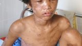 Xót xa nhìn lại những vụ bạo hành trẻ nhỏ gây chấn động dư luận
