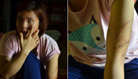 Tâm sự của người phụ nữ sau li hôn vẫn bị chồng đánh nhập viện