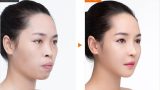Cuộc sống như mơ của Vũ Thanh Quỳnh – hot girl phẫu thuật thẩm mỹ