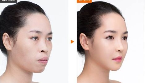 Cuộc sống như mơ của Vũ Thanh Quỳnh – hot girl phẫu thuật thẩm mỹ