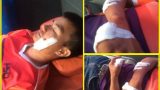 Nam Định: Tài xế xe buýt bị chém nhập viện nghi mâu thuẫn giành khách