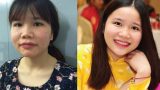 Nữ sinh Nam Định “vịt hóa thiên nga” chỉ sau 2 tháng Nữ sinh Nam Định “vịt hóa thiên nga” chỉ sau 2 tháng