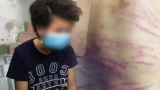 Cháu bé nghi bị mẹ đánh đập, người tình của mẹ xâm hại nhiều lần: “Cháu chỉ ước không phải về ngôi nhà đó sống nữa”