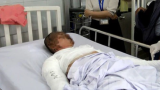 Cháy toàn thân, hỏng mắt do lên mạng học cách chế pháo nổ chơi Tết