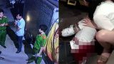 Công an Nam Định lên tiếng vụ nam thanh niên bị 2 kẻ bịt mặt chém tàn bạo