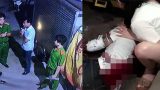 Công an Nam Định lên tiếng vụ nam thanh niên bị 2 kẻ bịt mặt chém tàn bạo
