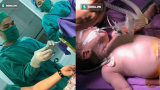 Cứu sống một trẻ sơ sinh bị thoát vị rốn bẩm sinh ở Nam Định