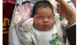 Gặp lại bé trai có cân nặng “khổng lồ” ngay lúc lọt lòng ở Nam Định Gặp lại bé trai có cân nặng “khổng lồ” ngay lúc lọt lòng ở Nam Định