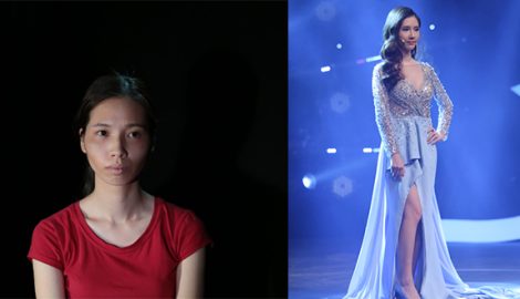 Nữ 9x Nam Định được khen xinh như hotgirl sau phẫu thuật thẩm mỹ