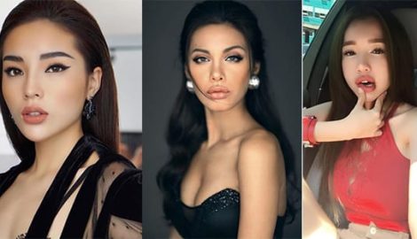 Kỳ Duyên và những người đẹp ‘đoạn tuyệt’ với môi mỏng dính để tìm đến môi tều căng mọng