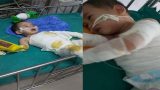 Nam Trực: Bé trai 2 tuổi vấp ngã vào chảo dầu sôi rất mong nhận được sự giúp đỡ