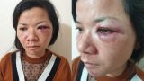 Người chồng đánh đập vợ dã man ở Nam Định bị phạt gần 5 triệu đồng