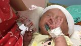 Xót xa bé trai não úng thủy đang mất dần sự sống Xót xa bé trai não úng thủy đang mất dần sự sống