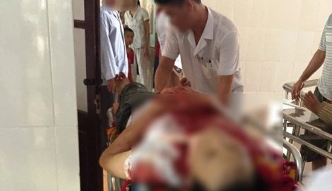 Vụ vợ chết, chồng thoi thóp: Vẫn chưa lấy được lời khai từ người chồng