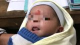 Bé gái sơ sinh bị bỏ rơi, kiến bám đầy người