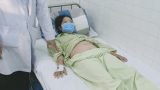 Ăn nhanh, nuốt vội, người phụ nữ bị xương cá đâm thủng ruột